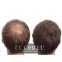 Ecobell Corrector Creme für Alopezie eco_fluid50 by Ecobell