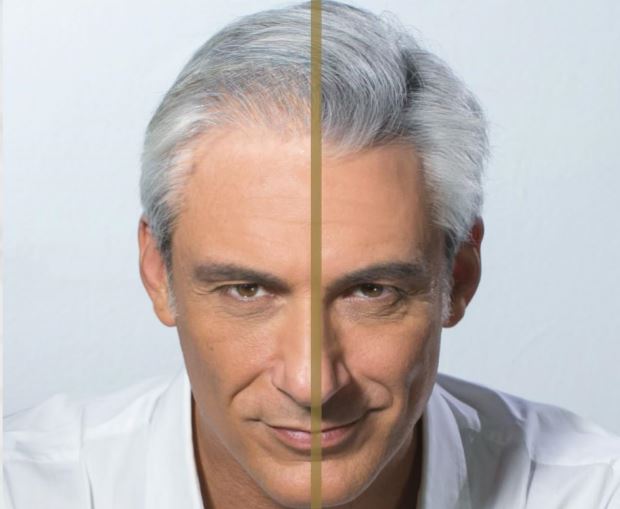 diradamento capelli prima e dopo