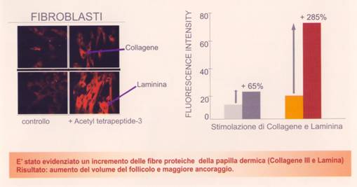 fibrolasti